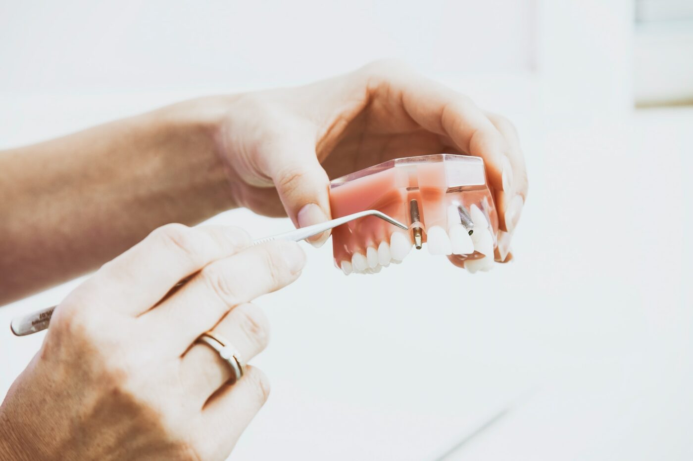 dental implants demo