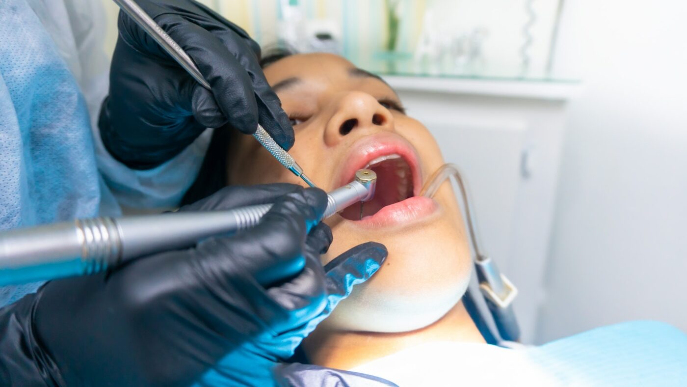 dental cleaning, dental tourism in costa rica