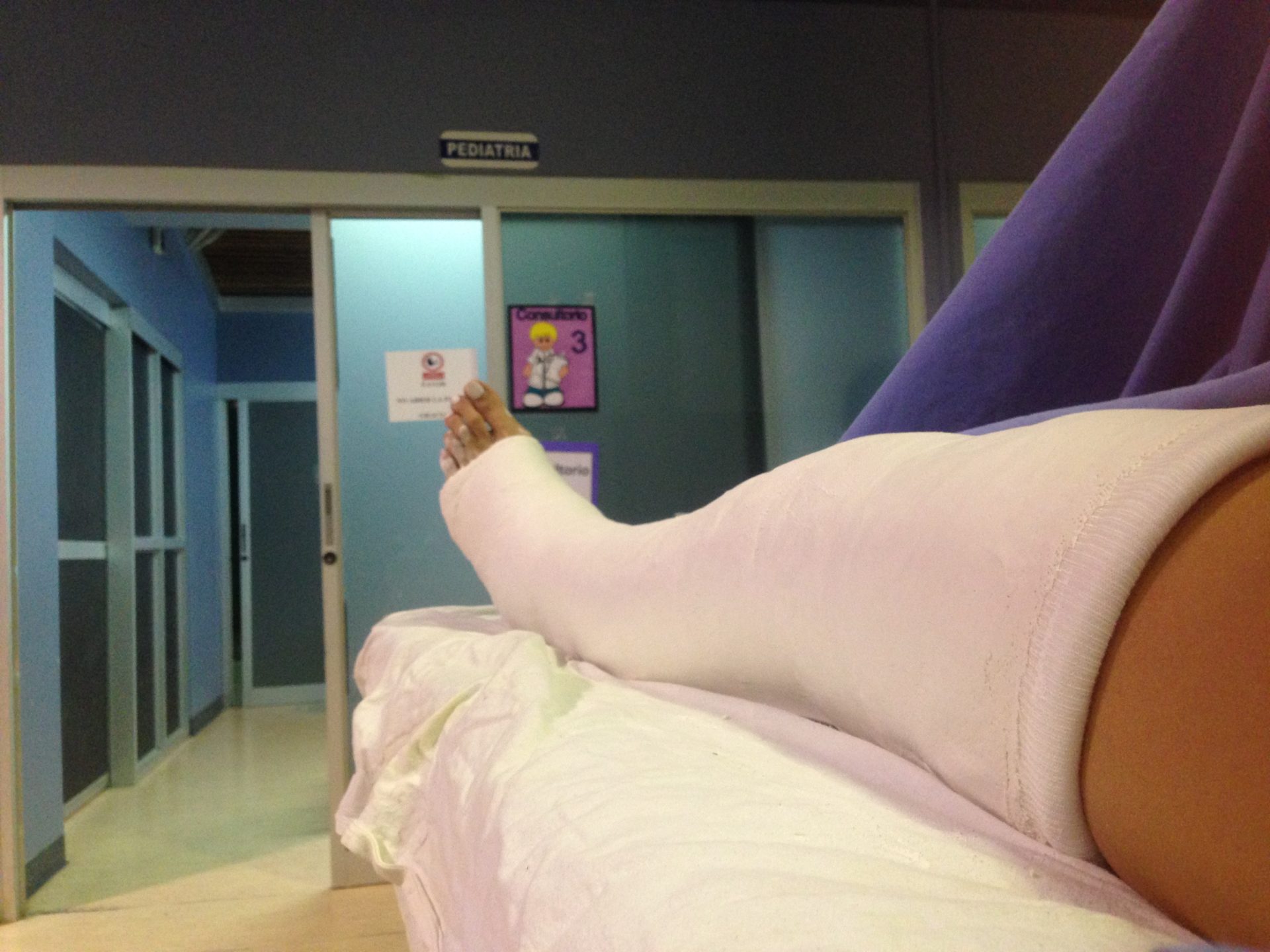 Oksana's broken leg in a cast. Nicoya hospital.Costa Rica